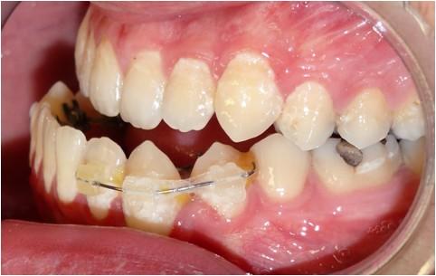 INTRA-ORAL VIEW COLOUR PHOTOGRAPHS