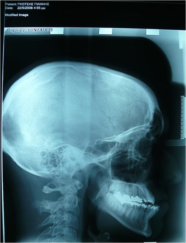 Lateral radiography