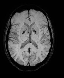 Brain MSK Without Compressed