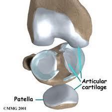 The most abundant type of cartilage in the human body.
