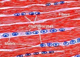 Fibrocartilage Contains a large amount of collagen fibres Stronger and