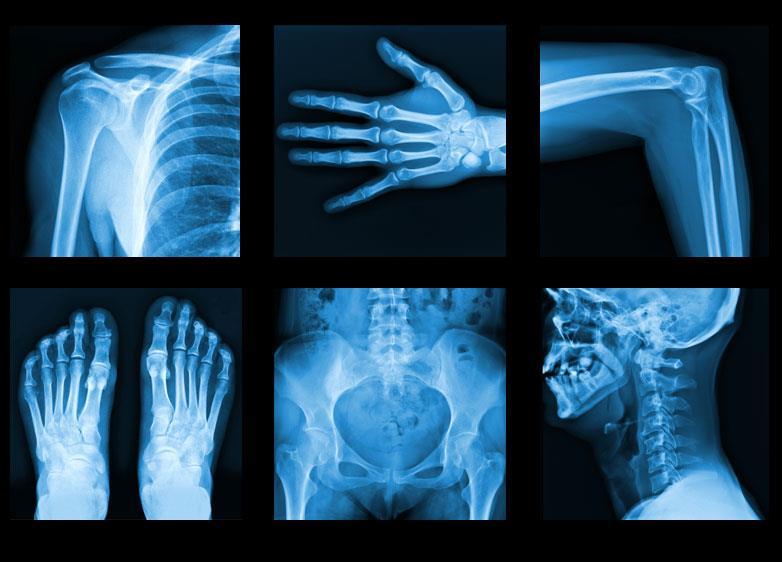 X-rays Used to look at bones and joints of humans and