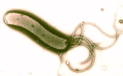 Conventional Perspective It was assume to have h. pylori related issues, you had to ingest it In other words - be infected with it They call it an h.