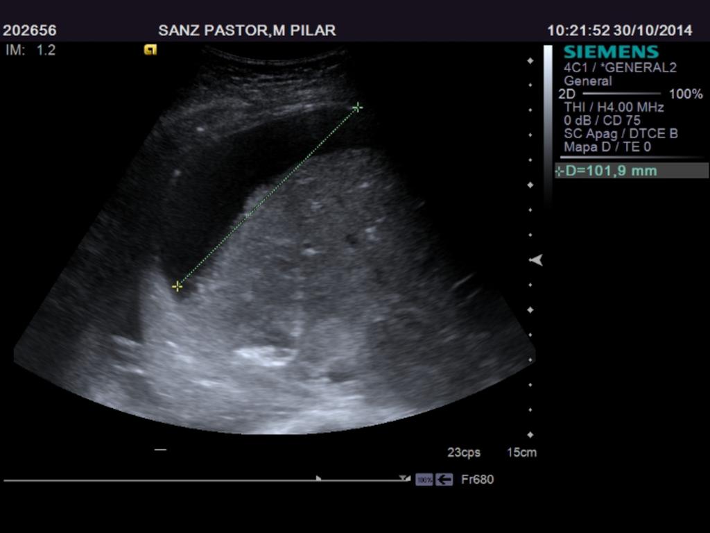 Fig. 15: Ultrasonnography 24