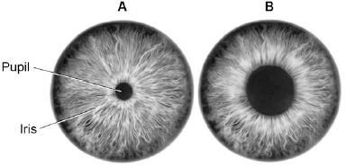 Q1.Figure 1 shows a reflex in the iris of the human eye in response to changes in light levels.