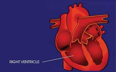 ventricle.