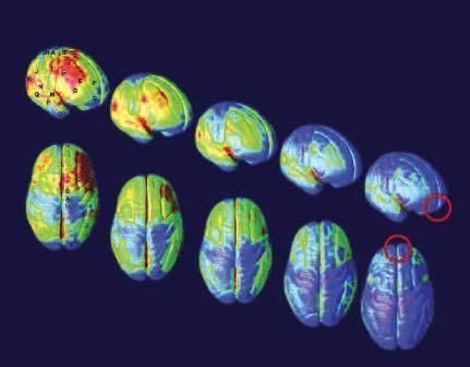 Early Use Images of Brain Development in Healthy Children and Teens: 5 20 years One of the brain areas still maturing during adolescence is the prefrontal cortex the part of the brain that enables us