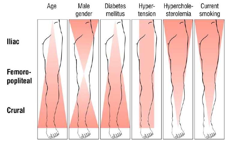 Association of cardiovascular risk factors with pattern of lower limb