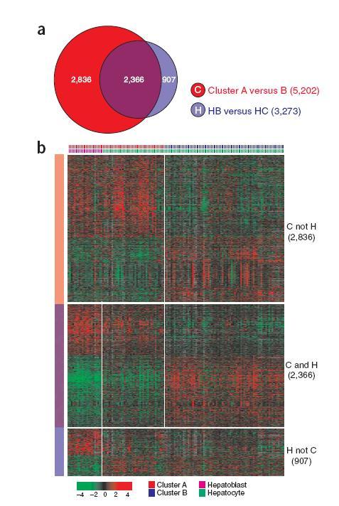 Hierarchical cluster analysis A unique gene expression signature only detectable in subtype HB Markers of HPC (KRT7, KRT19, VIM) Derivation from HPC?
