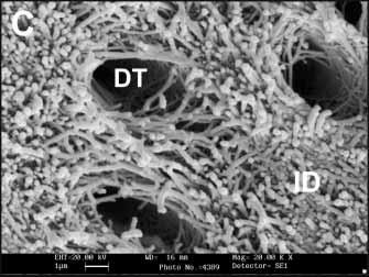 DT = dentin tubules; SEM observations revealed that the dentinal morphology of the three species was quite similar with respect to tubule number and diameter in the regions studied (Fig 1).