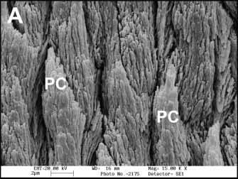 Fig 2a SEM micrograph of human enamel. PC = prism cores. Original magnification 15,000X. Fig 2b SEM micrograph of bovine enamel. PC = prism cores. Original magnification 15,000X. Fig 2c SEM micrograph of porcine enamel.