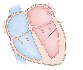 ANATOMY OF THE HEART O The heart is divided into right and left hand side by the
