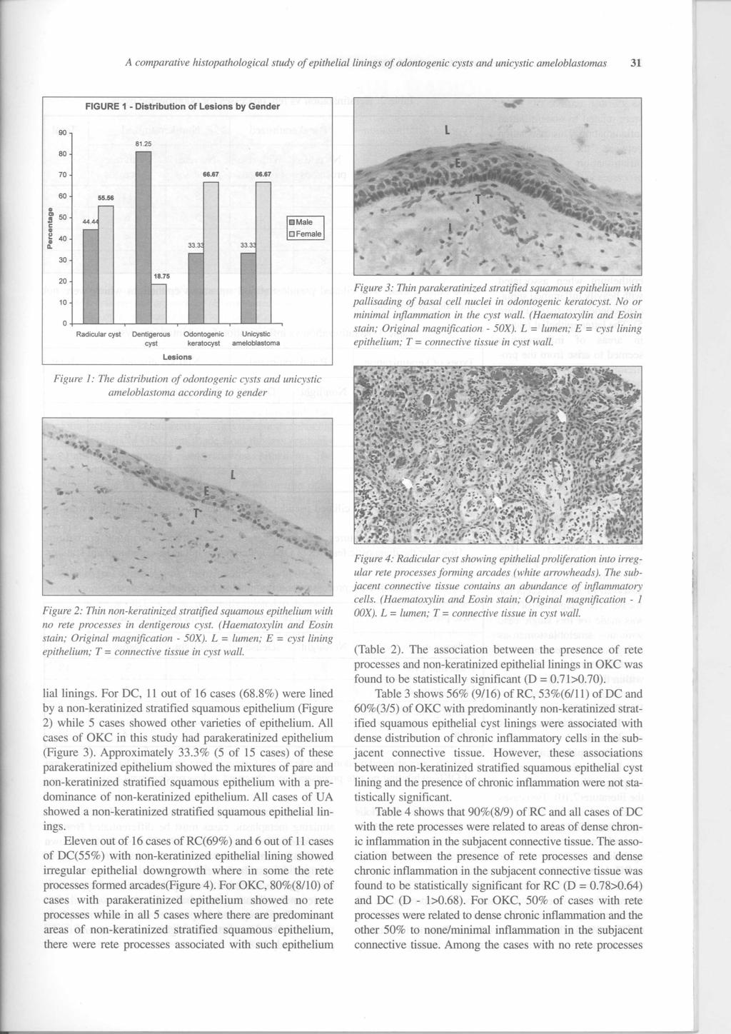 A comparative histopathological study of epithelial linings of odontogenic cysts and unicystic ameloblastomas 31 FIGURE 1 - Distribution of lesions by Gender 90 l 80 81.25 70 66.67 66.67 60 55.