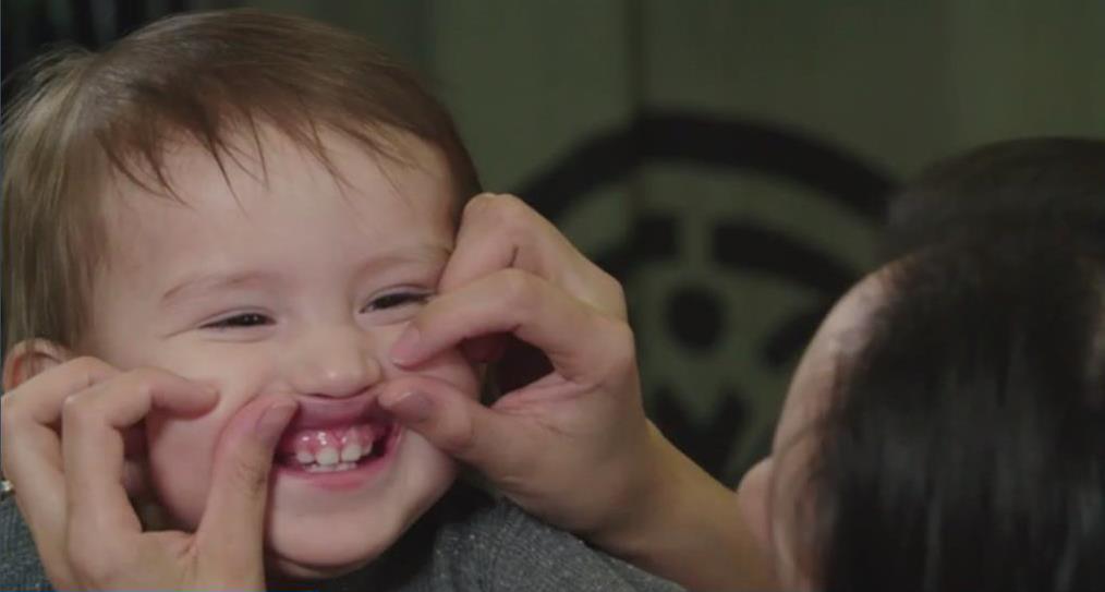 Lift the Lip Video Created by Healthy Smile Happy Child, in partnership with the CPNP program, healthy Start for Mom & Me, and with