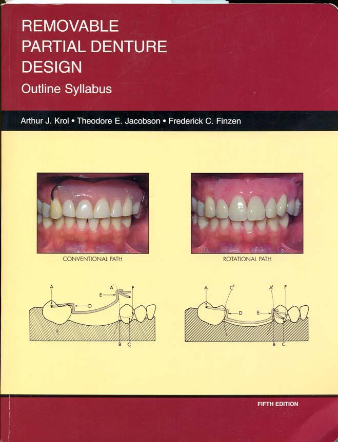 Rotational Path Concepts Images from Krol, A.J., Jacobson, T.E., & Finzen, F.C. (1999). Removable Partial Denture Design: Outline Syllabus (5th ed).