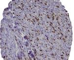 Data on IHC expression in relation to LR are scarce, but Maula et al.