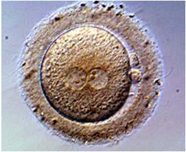IVF TREATMENT INFERTILITY NOW AFFECTS ONE