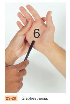 Cortical Sensation Exam 3. Graphesthesia TEST The patients palm should be positioned facing the examiner, with fingers pointed upward as if signalling stop. Ask the client to close their eyes.