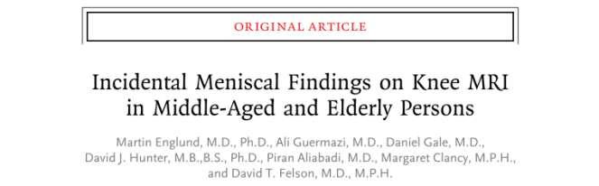 MENISCAL TEAR: EPIDEMIOLOGY As the severity of osteoarthritis increases, so does the frequency of meniscal tears: among those with severe osteoarthritis, 95% had