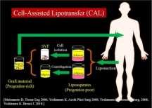 CONCLUSION FURTHER STUDIES ARE REQUIRED ESPECIALLY WITH LIPOFILLING USING STEM CELLS ENHANCEMENT