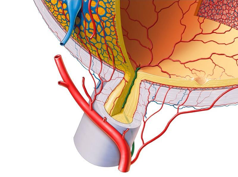 Occlusion of central artery of retina results
