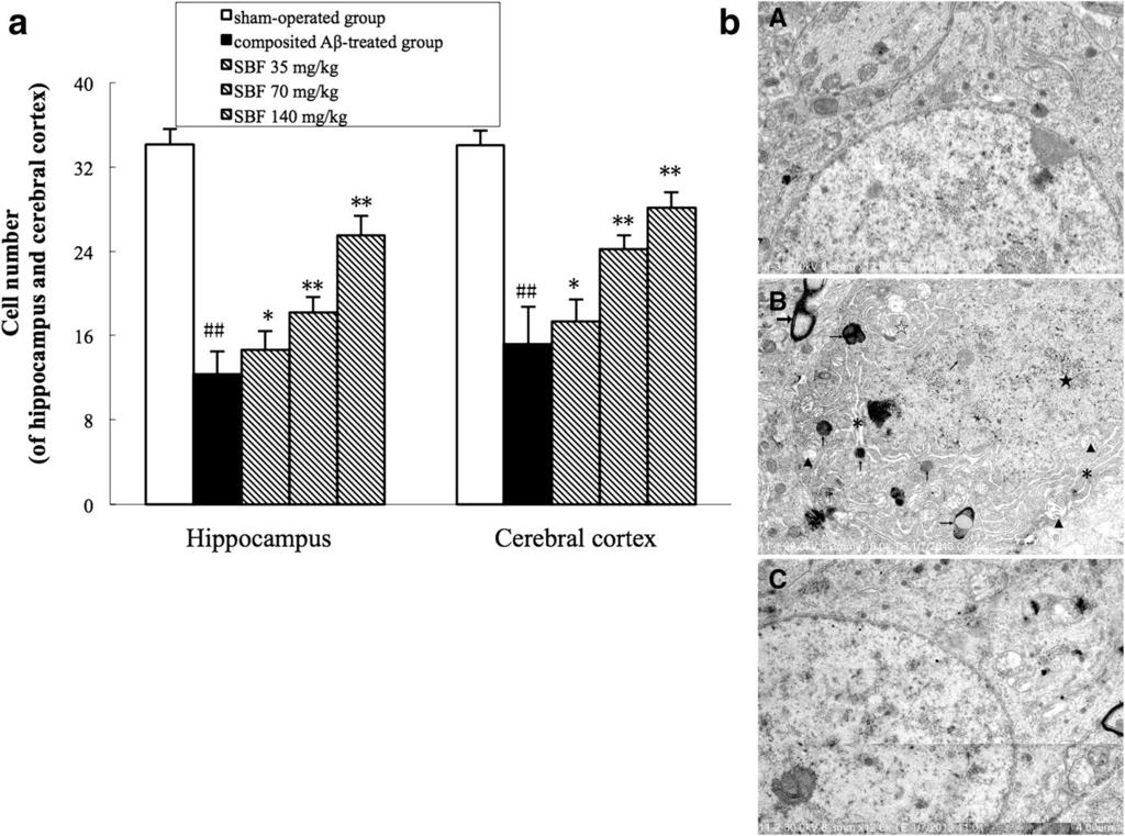 Page 9 of 10 (See figure on previous page.) Fig. 5 Effects of SBF on pathological changes in the hippocampus and cerebral cortex induced by composited Aβ in rats.
