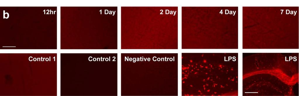 (control 1 and 2 = ND). A negative control was included where the primary antibody was omitted.