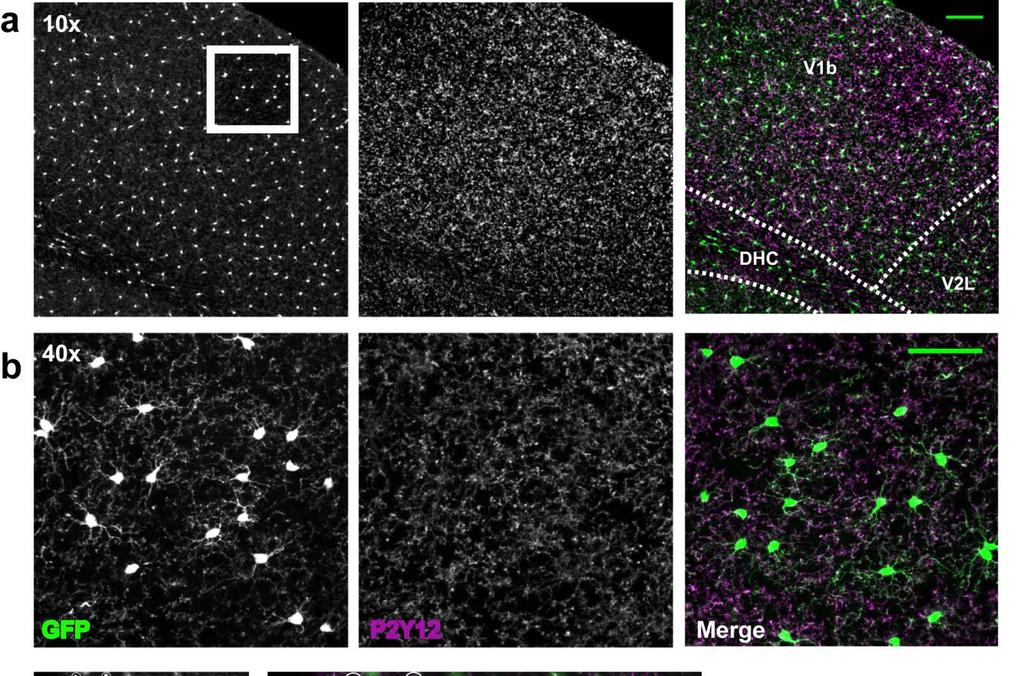 3 Supplementary Figure 3. P2Y12 is highly expressed in cortical microglia a-b. Confocal images of P2Y12 immunoreactivity in V1b of CXC3CR1 GFP/+ mice showing high expression on microglial processes.