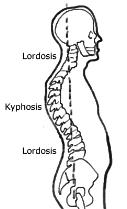 cervical lordosis and kyphosis the