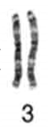 division stage Reduction Stage: Starting with a full 46 chromosome