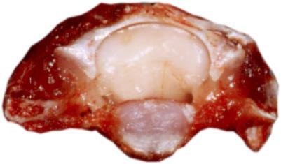 APD of vertebral body: 1.9 times (APD= Anteroposterior diameter ) 1 year old rat BW.