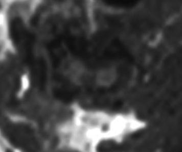 Transverse area at C4 (mm 2 ) Control rat MR imaging study