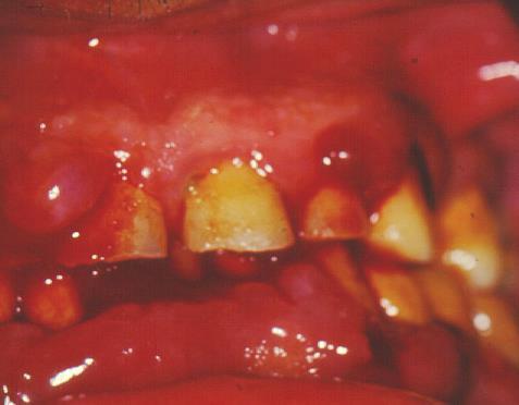 Diseases of leukopoietic system The role of dentist is more important in the