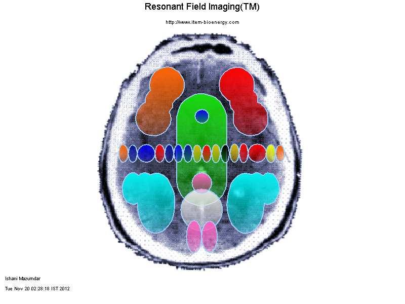 RESONANT FIELD IMAGING Brain Image Interpretations Subject: XYZ Investigator: Nishant Date: Tue Nov 20 02:28:18 IST 2012 Session Notes: Sample report RFI is designed only for use in health psychology