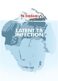 Tuberculsis Glbal Emergency T treat TB, we have t catch it early,