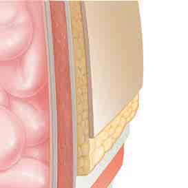 Where Hernias Happen The type of hernia you have depends on its location.