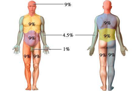 SJS Stevens-Johnson Syndrome Also known as Erythema Major Definition SJS if less than 10% of TBSA is detached SJS/TEN if 10-30% of TBSA is detached Can be life threatening or altering Mortality rate: