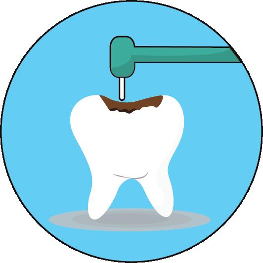 DENTAL CARE ASSISTANCE 11.ROOT CANAL: $325-650 Gifts to this funding category will provide care to remove rotted teeth and help prevent worsening mouth conditions.