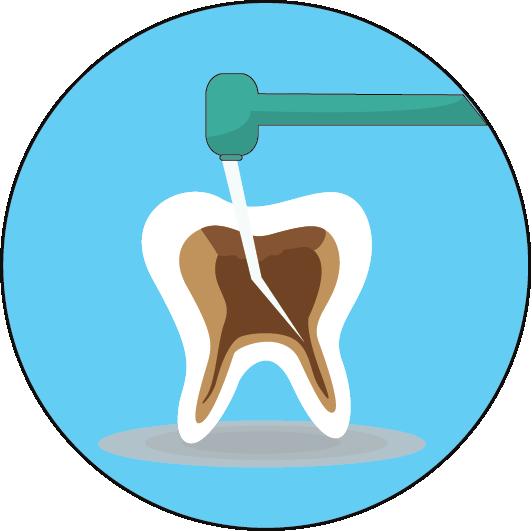Your generosity will provide for the diagnostic materials and care to fill a tooth.