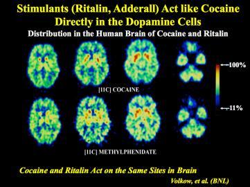 Types Effects on the Brain: Pain medications bind to the same receptors that respond to heroin.