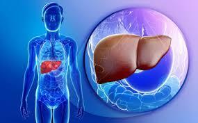 Steatohepatitis NAFLD Stages - Non Alcoholic Steatosis and NASH By Region- North America, Europe, Asia Pacific and ROW