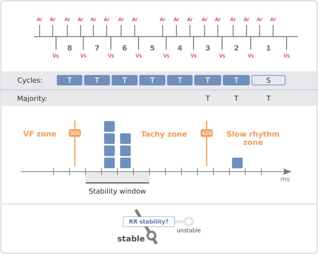 Reminder: A rhythm with a Tachy majority is considered stable if at least 75% (programmable value) of the cycles in the Tachy zone are stable.