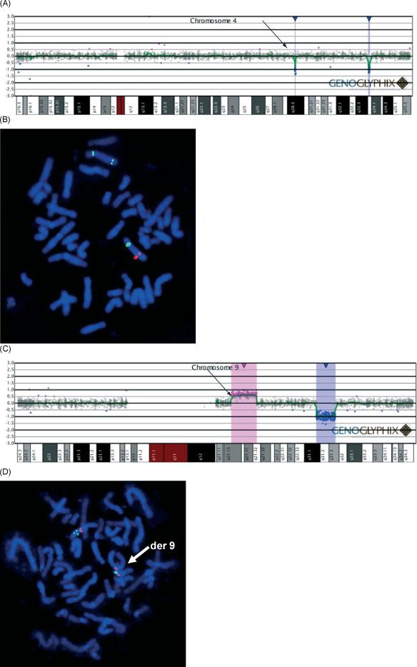 238 T.-H. BUI et al. Figure 2 Microarray and fluorescence in situ hybridization (FISH) results for apparent double segmental imbalances involving the same chromosome.