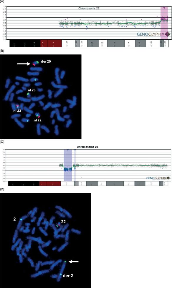 CURRENT CONTROVERSIES IN PRENATAL DIAGNOSIS 3 239 Figure 3 Microarray and fluorescence in situ hybridization (FISH) results for apparent single segmental imbalances. (A) Microarray result showing a 2.