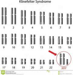 Alteratins f chrmsme number r structure cause sme genetic disrders 15.