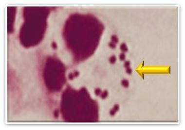 Arrow indicates bacterial cells inside a neutrophil. van Deuren M, et al. Clin Microbiol Rev. 2000;13:144. Broome CV. J Antimicrob Chemother.1986;18:25. Dull PM, et al. J Infect Dis.