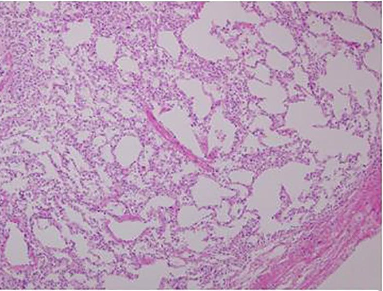 S1634 Kang et al. Novel stapler for oncologic surgery A B Figure 5 Pathologic findings of the true resection margin tissue (H&E, 100).