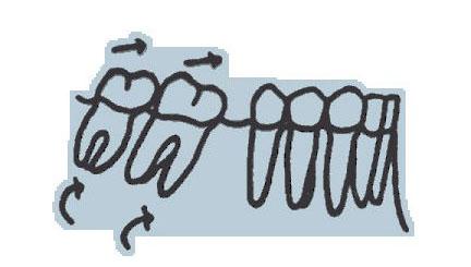 Mesial drift is a phenomenon of the movement of teeth toward