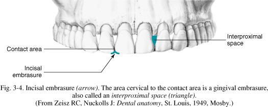Embrasures This feature of the dental arches is found occlusal to the contact area and is designed to direct the flow