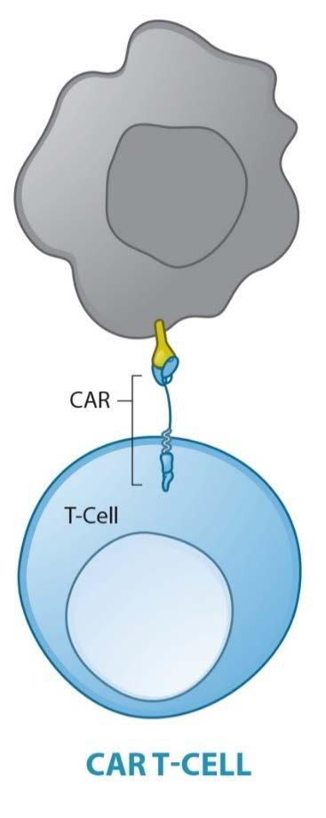 5 CAR T-cells Chimeric Antigen Receptors TUMOR CELL Lymphocytes are engineered in order to recognize specific tumor antigens and drive killing of the